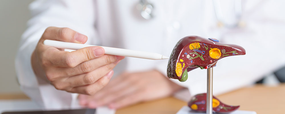 Fatty Liver Disease Treatment in Siliguri