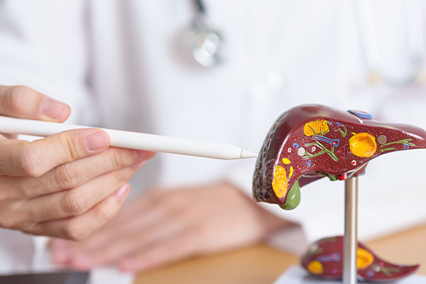 Fatty Liver Disease Treatment in Siliguri