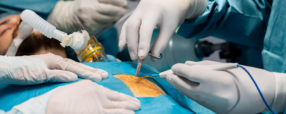 Liver Transplant Surgery in Siliguri