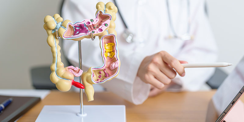 Gastrointestinal Oncology