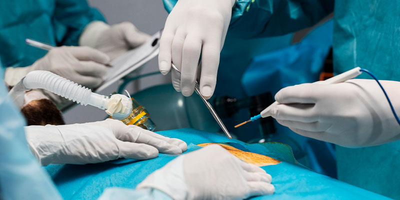 Transjugular Liver Biopsy