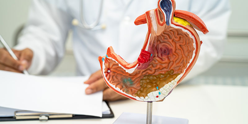 Treatment of Digestive Disorders